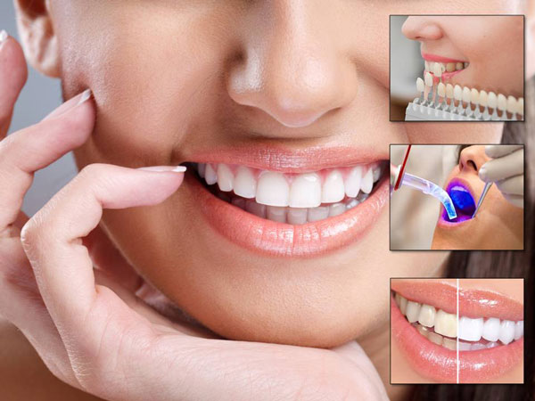 Best Dentist In Rohini - All Dental Treatments, Teeth Straigntning Braces