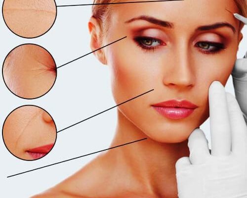 Botox - Derma Filler Botox - Derma Filler