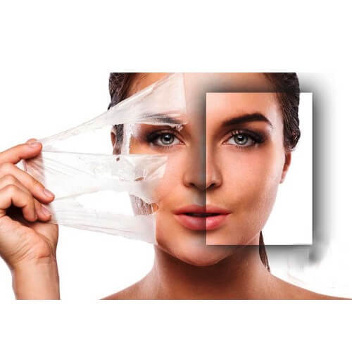 CHEMICAL PEELS